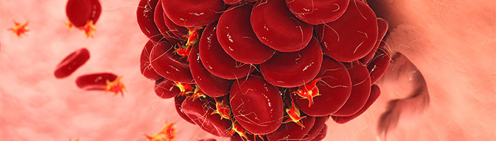 Генетики рассказали, у каких народов выше риск тромбоза