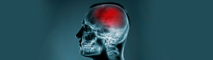 Курение приводит к атрофии головного мозга и деменции