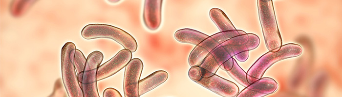 Ситуацию со вспышкой холеры на Гаити прокомментировал Роспотребнадзор Ситуацию со вспышкой холеры на Гаити прокомментировал Роспотребнадзор