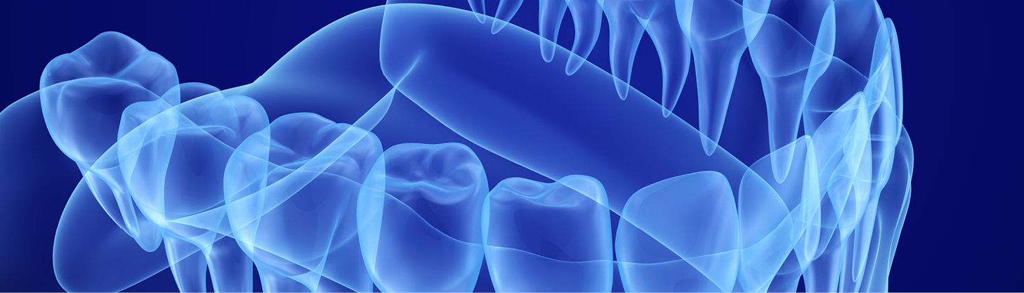 В Пермском Политехе создают первую в России универсальную платформу для производства элайнеров В Пермском Политехе создают первую в России универсальную платформу для производства элайнеров