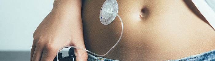 На территории РФ Росздравнадзором зарегистрировано 11 систем непрерывного мониторинга глюкозы На территории РФ Росздравнадзором зарегистрировано 11 систем непрерывного мониторинга глюкозы