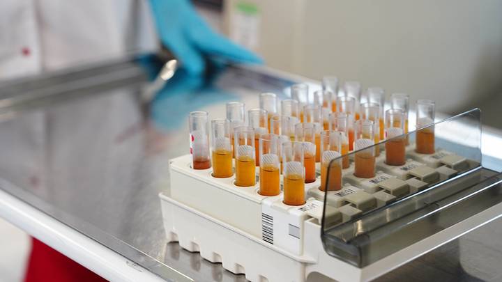 Первый в мире экспресс-тест на гепатит С создали в России Первый в мире экспресс-тест на гепатит С создали в России