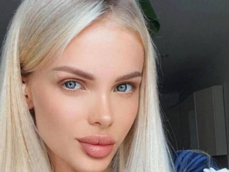 Лишившаяся части головы модель Анжелика Тартанова помирилась с бывшим-истязателем Лишившаяся части головы модель Анжелика Тартанова помирилась с бывшим-истязателем