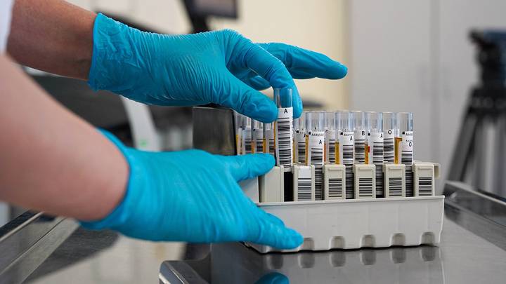 Ученые создали «биопортрет» рака ротоглотки, позволяющий лечить опухоль в щадящем режиме